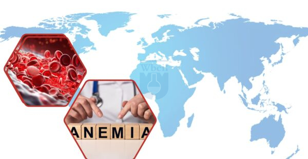 Iron deficiency anemia in Bangladesh